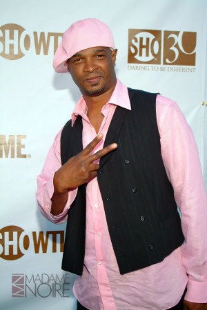 25 Celebrities With Physical Deformities