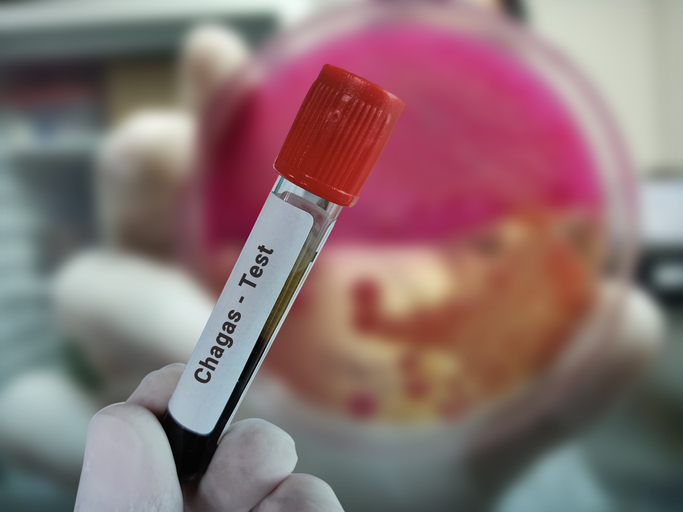 Blood sample for Chagas disease test.